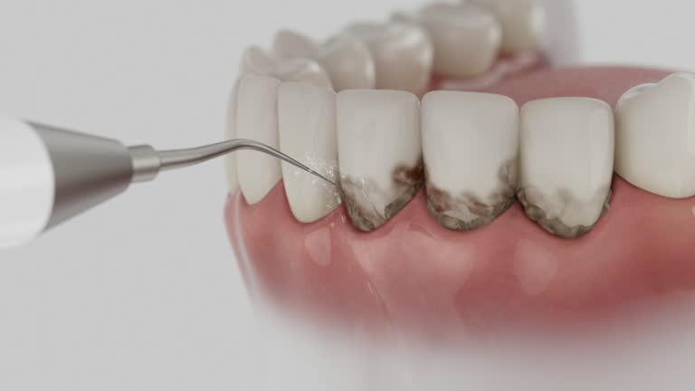 Trusted Wisdom Tooth Removal service in Blissfield, MI - Dentist Open Now